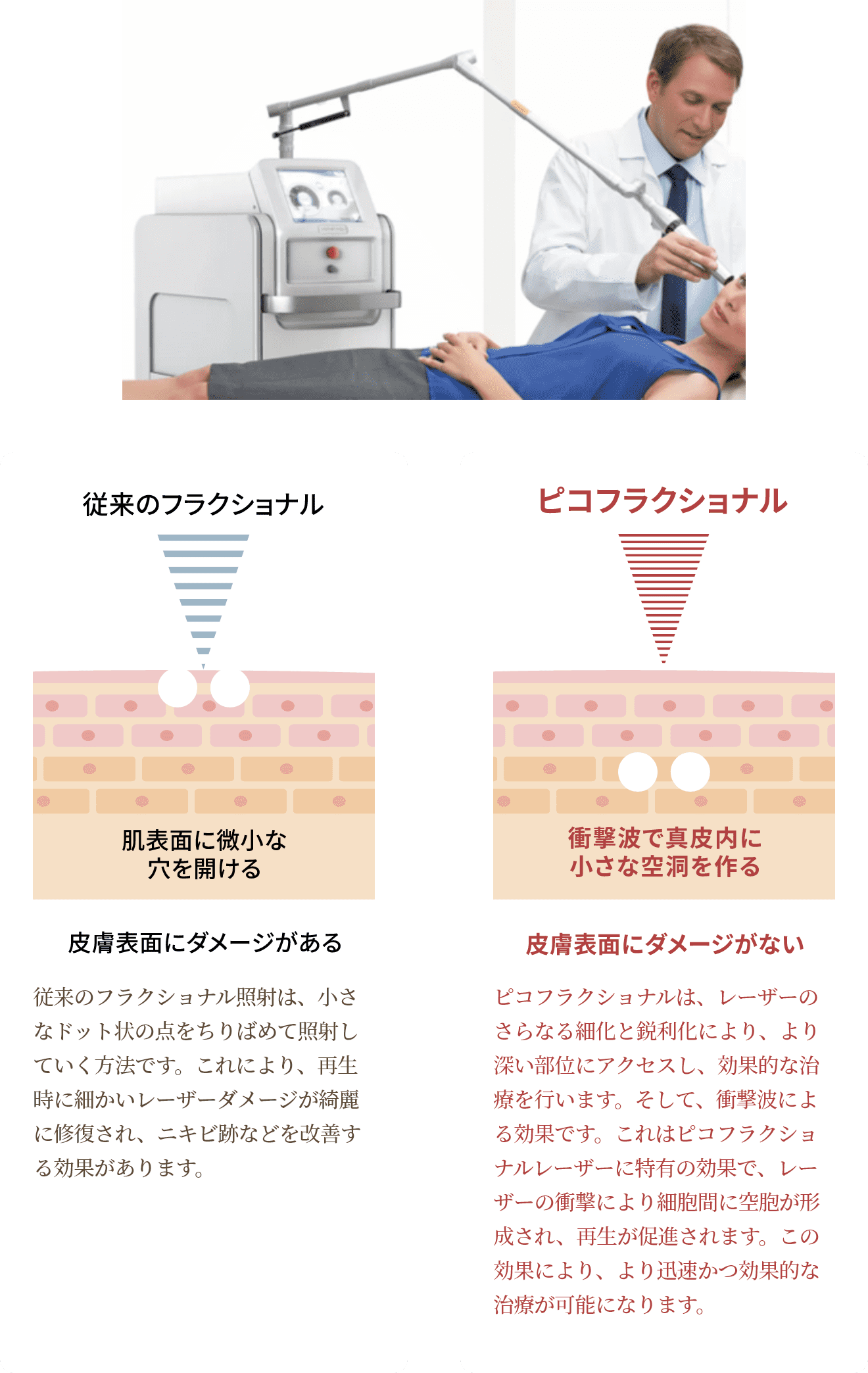 『PICOトーニング治療』